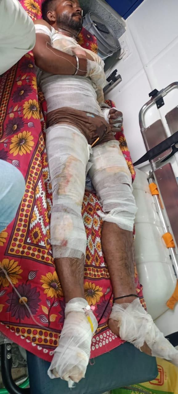 घायल बिजली मिस्त्री को इलाज हेतु आर्थिक मदद किया गोपिपतियांव पंचायत के पूर्व मुखिया मनोरंजन साह ने
