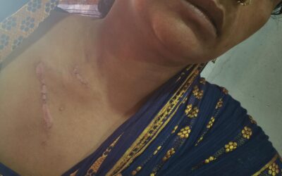 रघुनाथपुर : महिला को पूर्व सरपंच सहित छह लोगों ने मारकर किया जख्मी, प्राथमिकी दर्ज