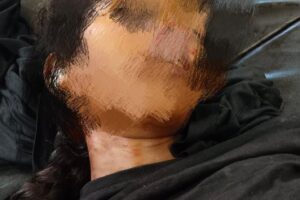 सीवान में मोटरसाइकिल की ठोकर से बिहार पुलिस के लिए दौड़ लगा रही युवती की मौके पर हुई मौत